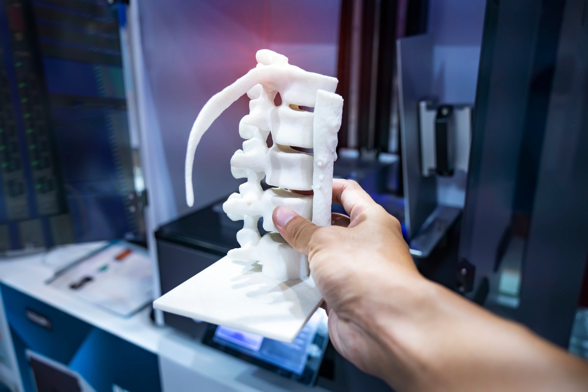 In this podcast, Atul Dhall, Engineering Consultant at TransAtlantic Science, talks about the benefits of creating custom implants, prosthetics, and surgical tools tailored to individual patients, as well as the ability to quickly prototype new devices. tinyurl.com/podcast-medtec…
