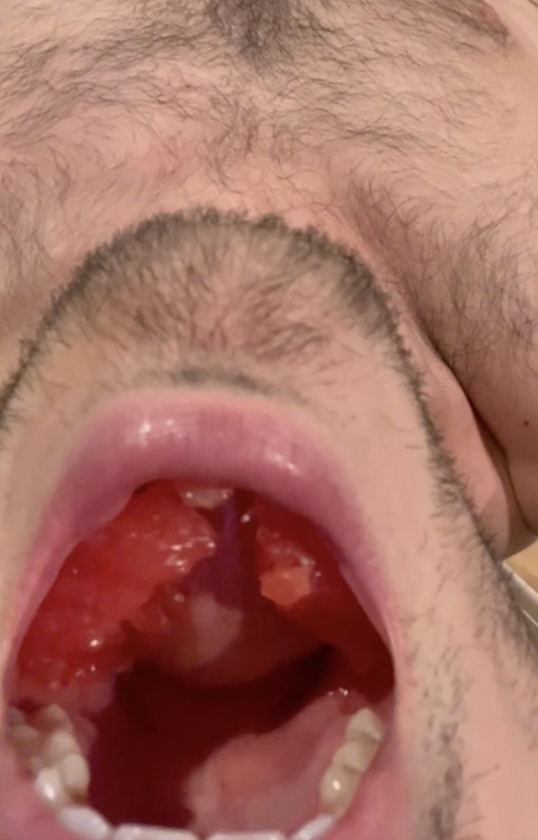 Vore_Alpha tweet media