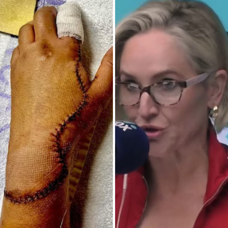 newscomauHQ's tweet photo. A Melbourne man almost lost his hand when a schoolboy allegedly slashed him in an unprovoked attack. What happened next has been polarising.
