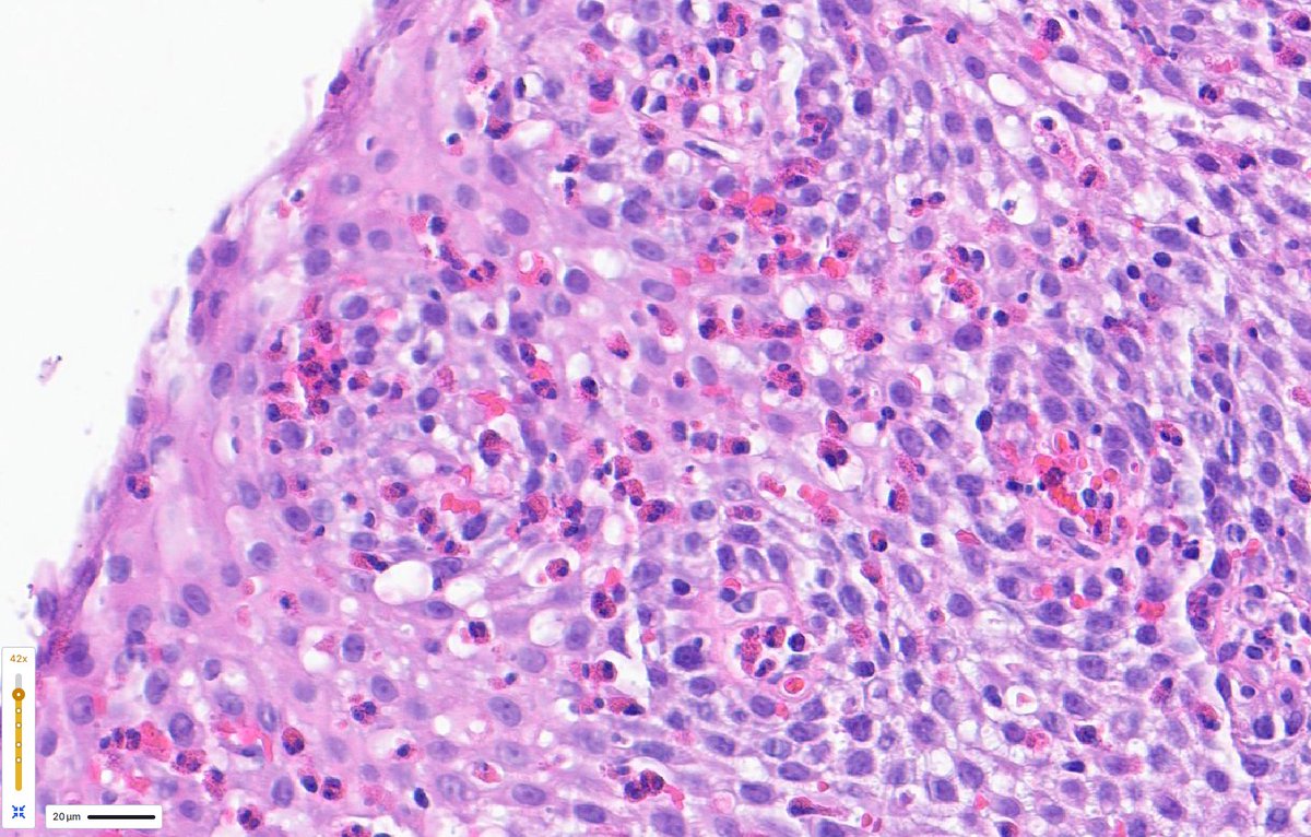 Douglas G. Adler MD, FASGE, FACG, AGAF tweet media