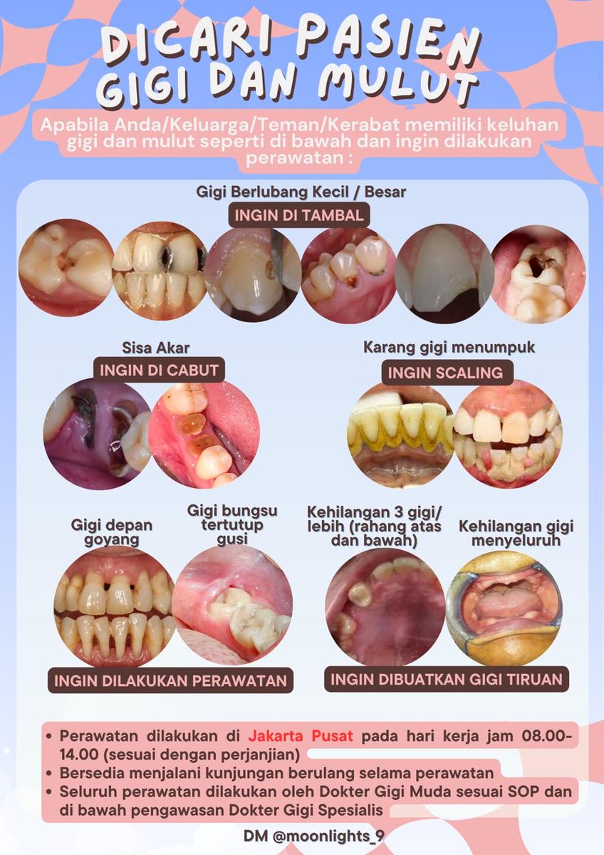 dicari pasien gigi yang kondisi giginya seperti pada gambar 🫶🏻

yg mau perawatan di daerah jakpus boleh dm 

kalau ada ortu atau kerabat yang kondisinya ky gitu jugaa boleh 

#tambalgigi #gigitiruan #gigigoyang #scaling #zonauang #wts #wtb