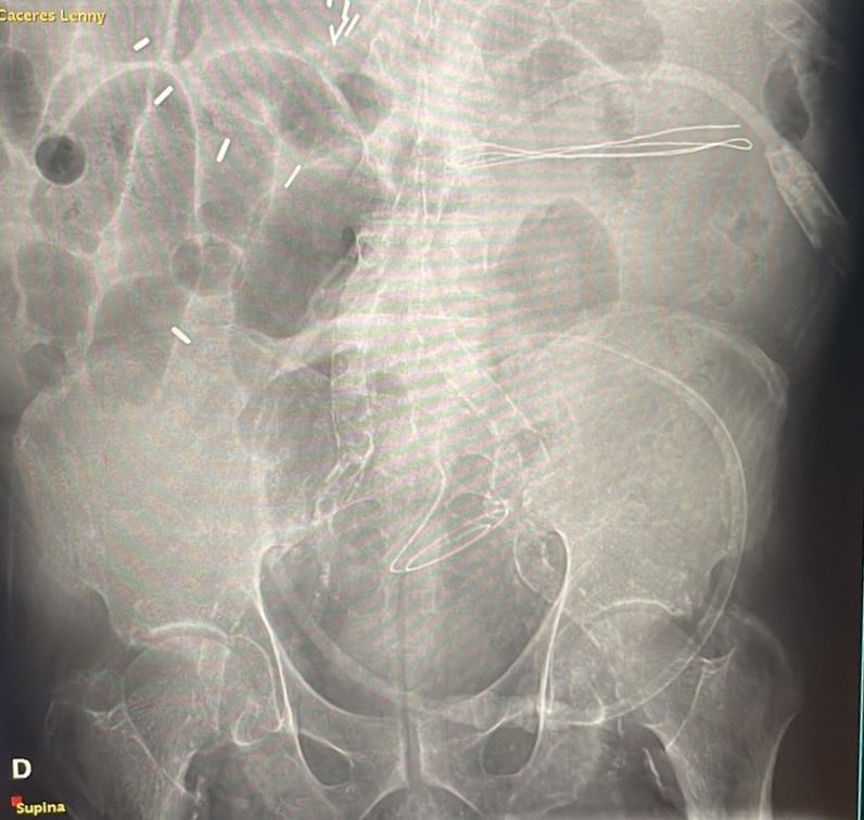 Ronald Valdez Imbert tweet media