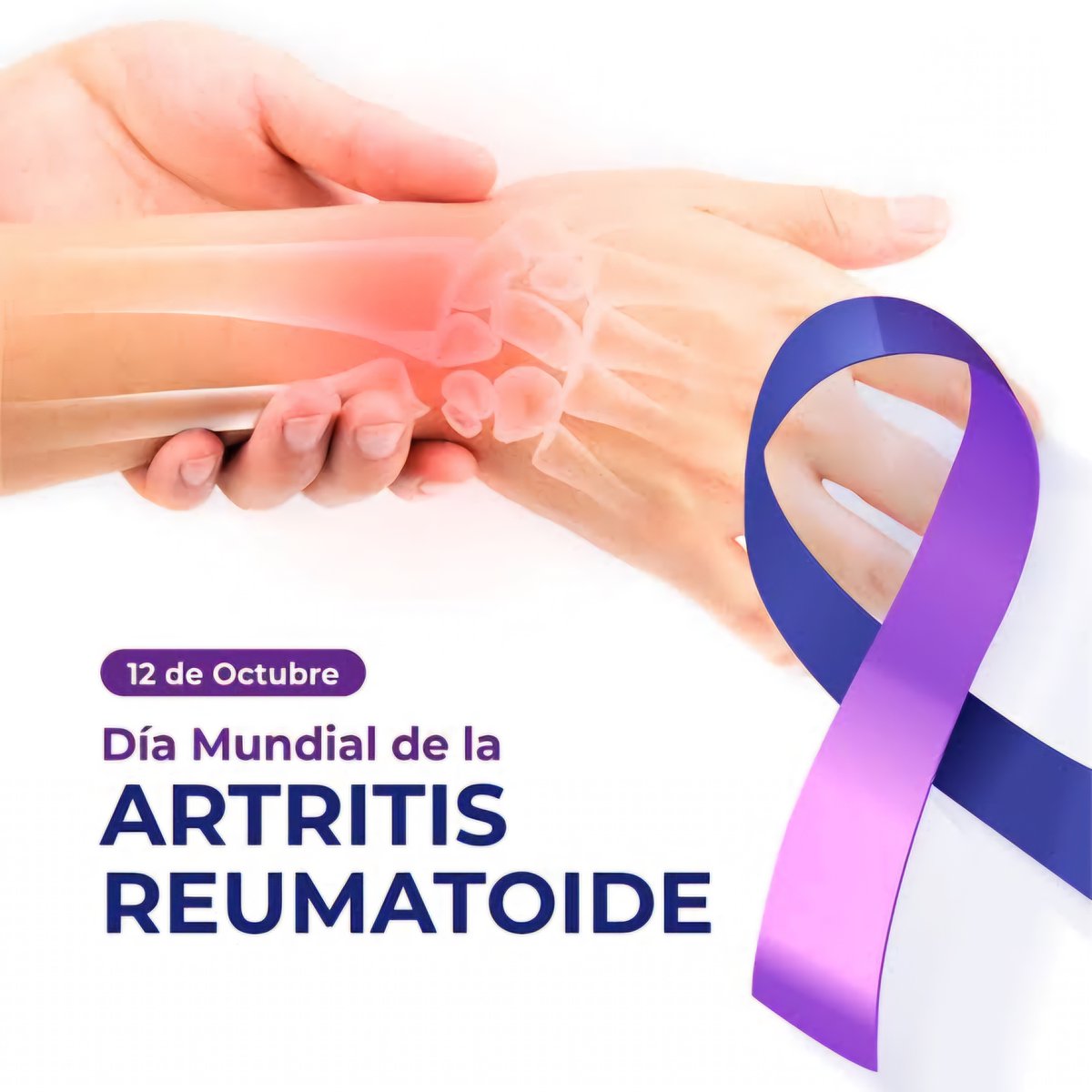 Alexpersanchez's tweet photo. El 12 de octubre se conmemora el #DíaMundialDeLaArtritisReumatoide, fecha que se institucionalizó desde 1996, con el objetivo de educar a las personas sobre esta enfermedad, promover una mejor calidad de vida y tratamientos para quienes la padecen. 
@HospitalJobabo https://t.co/7xlA4Ao8Gy