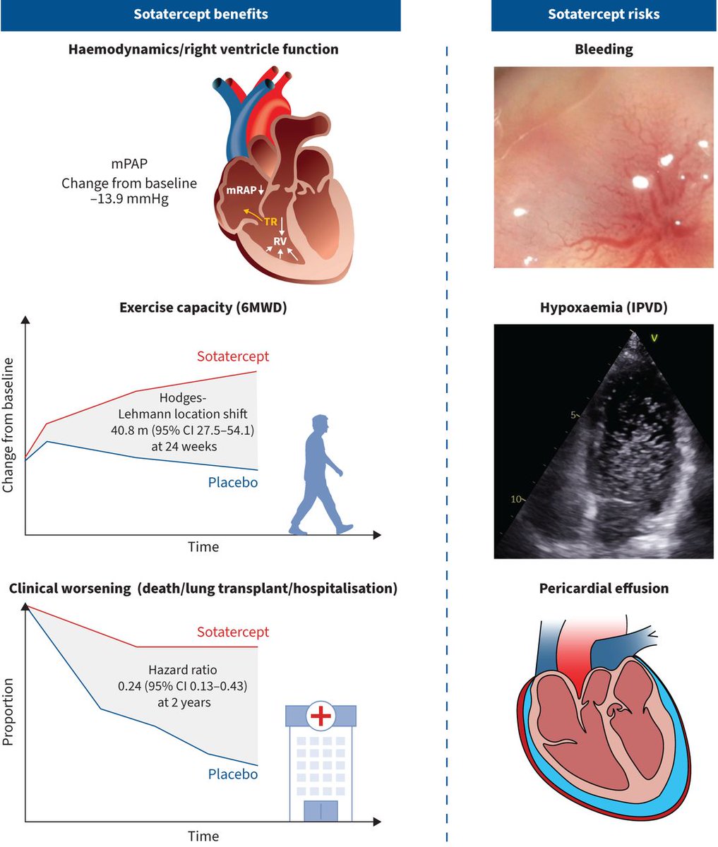 European Respiratory Journal: The activin signalling inhibitor sotatercept may transform PAH therapy by targeting pulmonary vascular remodelling, but unique safety risks demand careful monitoring bit.ly/3UBsPVj
