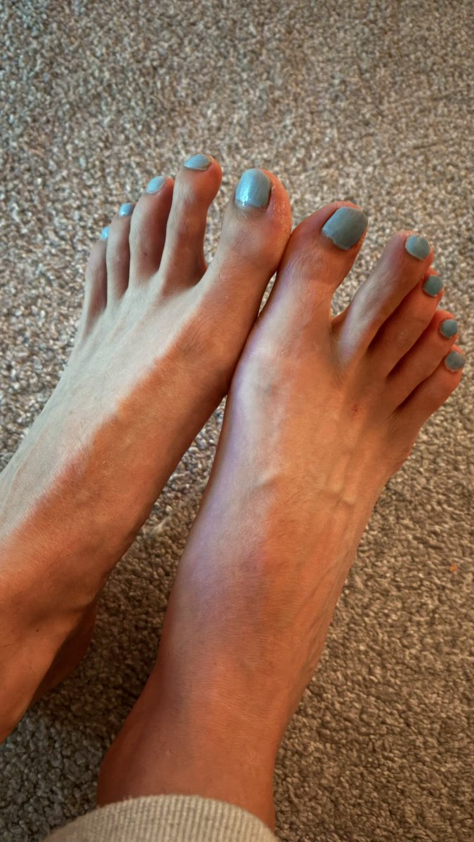 Strategically standing waiting on the kettle boiling #prettyfeet #toestuesday