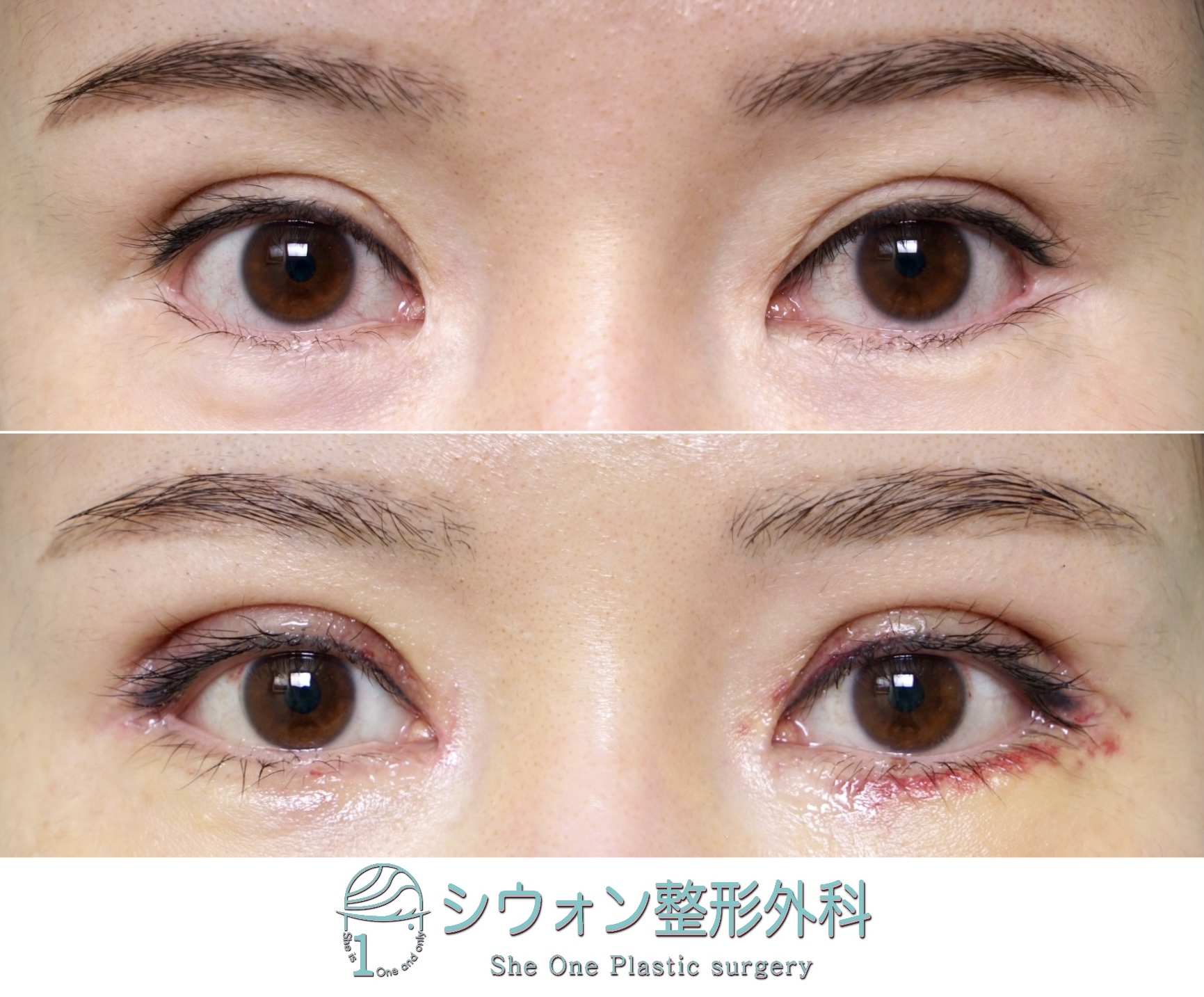 シウォン整形外科 on X: 