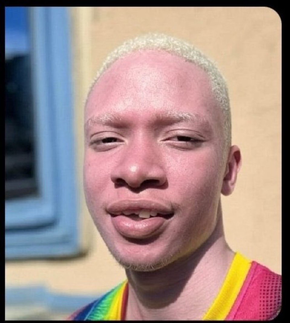 When you mistakenly wash that black shirt with hypo. 😭