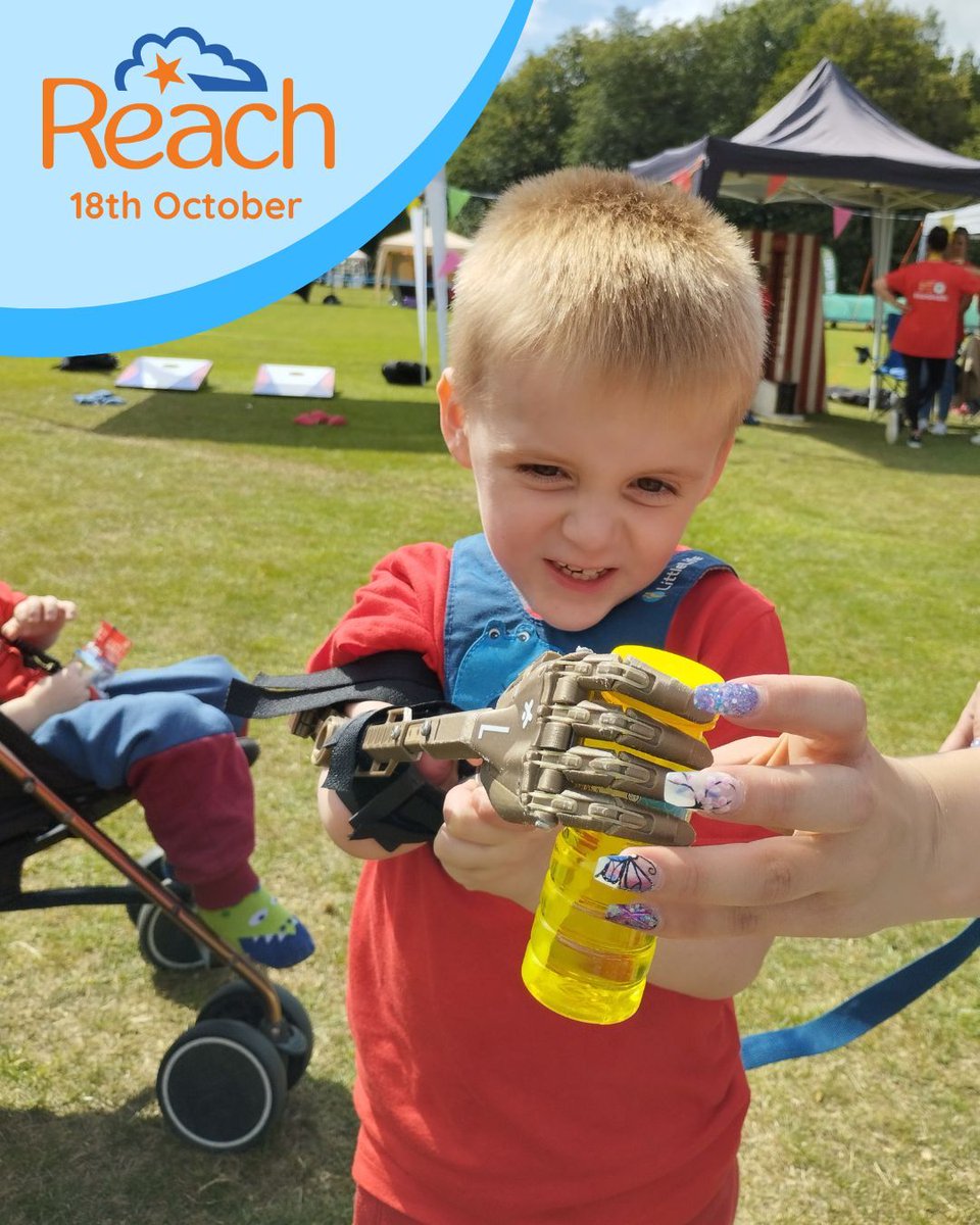 We’re so excited to be at the @reachcharityuk Annual Family Weekend this Saturday in Swansea! 🌊

Come say hi and give the ExpHand a try 💪🫧  

#ReachFoundation #FamilyWeekend #SwanseaEvents #ExpHand #Prosthetics #InclusionMatters #AccessibilityForAll #LimbDifferenceAwareness