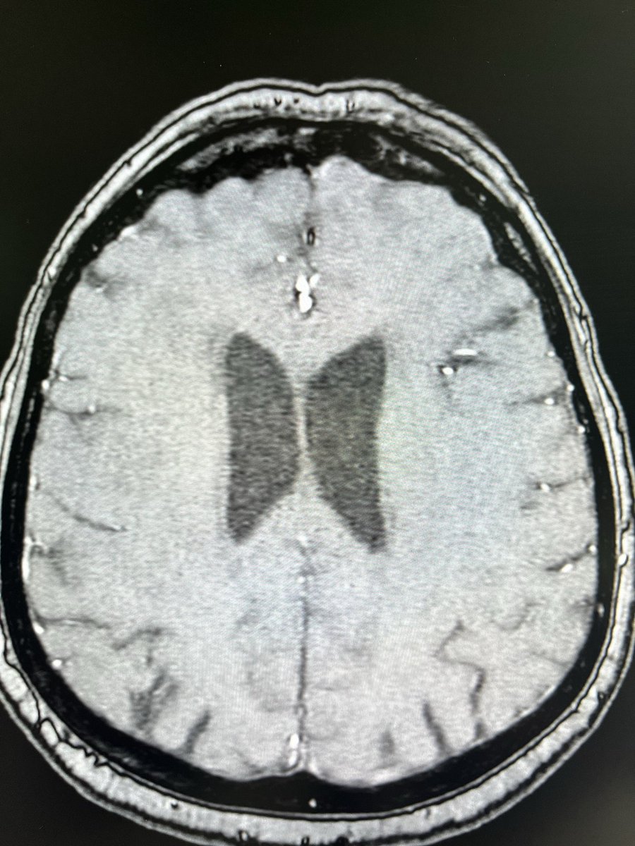 _christophermak's tweet image. bir seyin logosuna benziyor