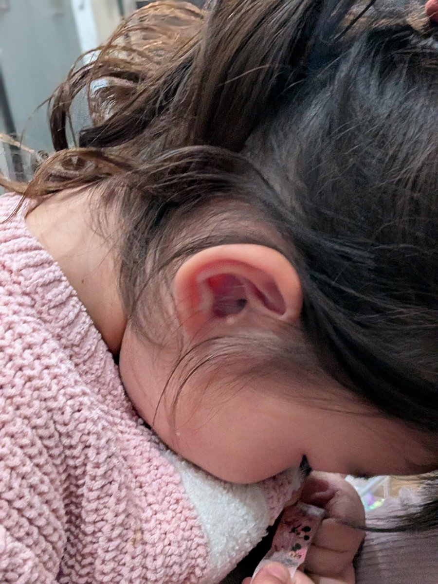 これは、一生懸命マスキングテープを切ろうとしている子のほっぺ。