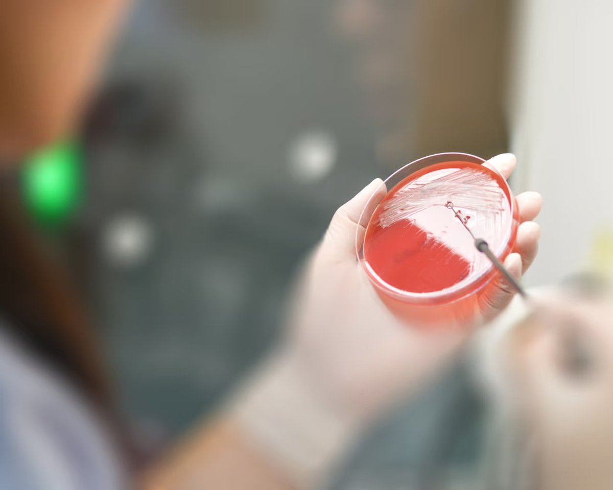 gardp_amr's tweet image. 📑 A new @guardian opinion article by GARDP’s Executive Director, Dr Manica Balasegaram, warns that drug-resistant infections have reached a critical tipping point.
Key findings:
📉 Only 5 out of 90 antimicrobials in development are innovative and target WHO priority pathogen.…