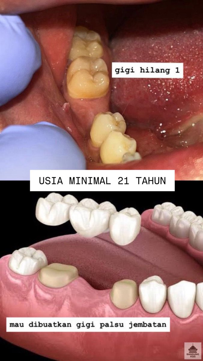 rara // koas gigi malang🦷🧚♂️ // cari pasien PSA tweet media