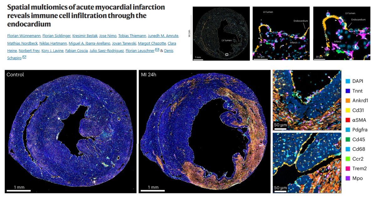 HaoYin20's tweet image. #SpatialOmics #MyocardialInfarction
#MolecularCartography 100-gene + #SeqIF 12-marker + #DeepVisualProteomics
4/24/49/96 h postMI🐭
Endocardial vWF mediates Mɸ infiltr
Anti-vWF i.v. reduces Mɸ at endocardial, but not epicardial, core or border, zone, but causes infarct wall…
