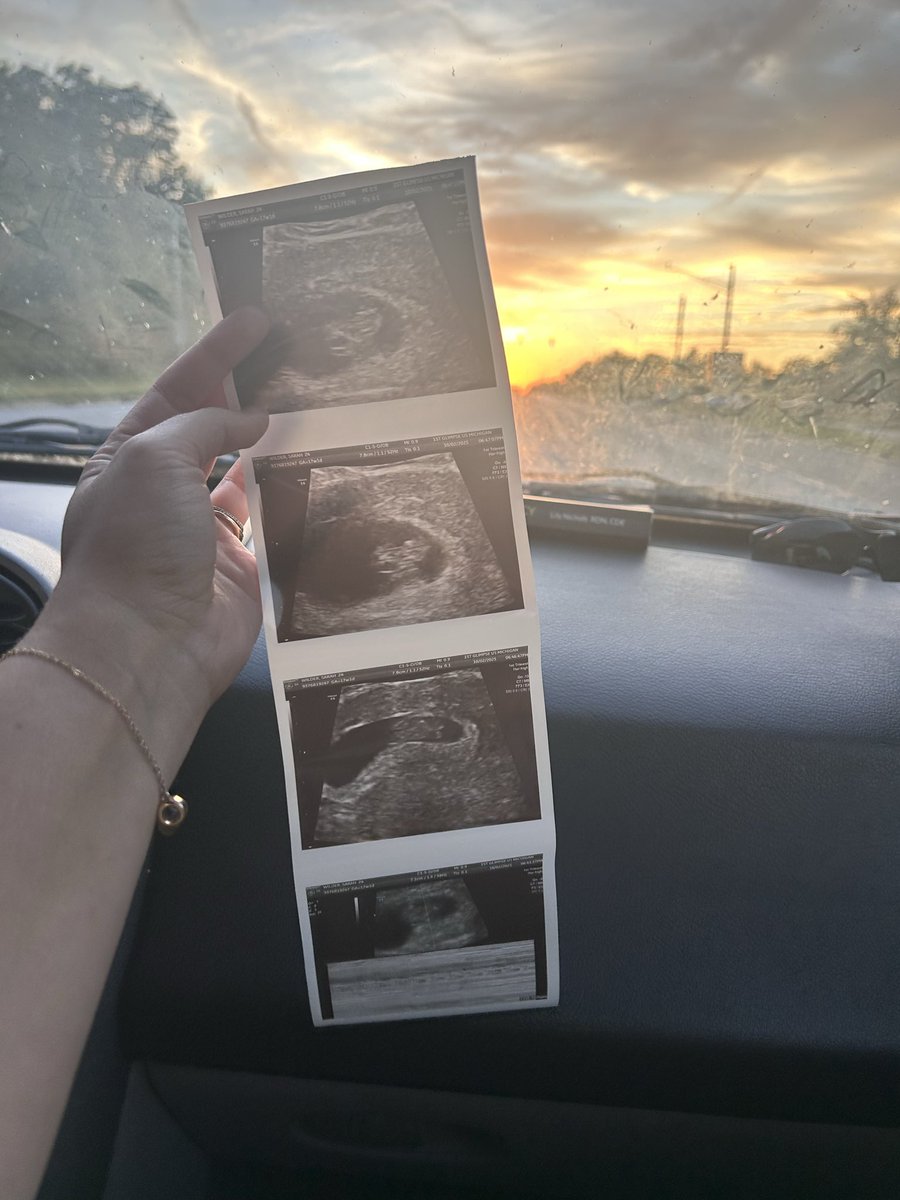 Two years of marriage today. Celebrating the gift of three babies — one here, one in heaven, one on the way. 

Love this life with you <a href="/Blacksmith1861/">Chase Wilder</a>. 🤍 We are so blessed!