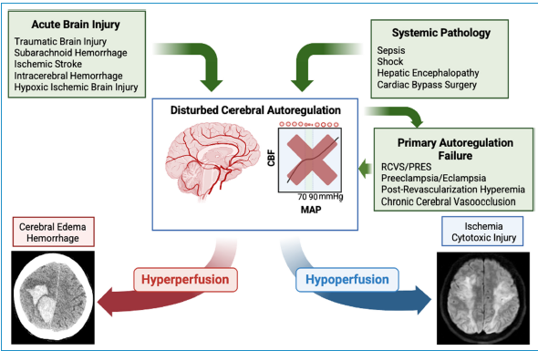 ISICEM's tweet photo. @ISICEM 𝐂𝐫𝐢𝐭𝐢𝐜𝐚𝐥 𝐂𝐚𝐫𝐞 𝐈𝐧𝐩𝐮𝐭
Determination of Cerebral Autoregulation at
the Bedside: A Narrative Review
🔗https://t.co/A5eYXDtlA2
#ISICEMelearning #MedEd #intensivecare #Sepsis #hypoxic #ischemicshock #ischemic #hyperperfusion #hypoperfusion #cerebralAutoregulation