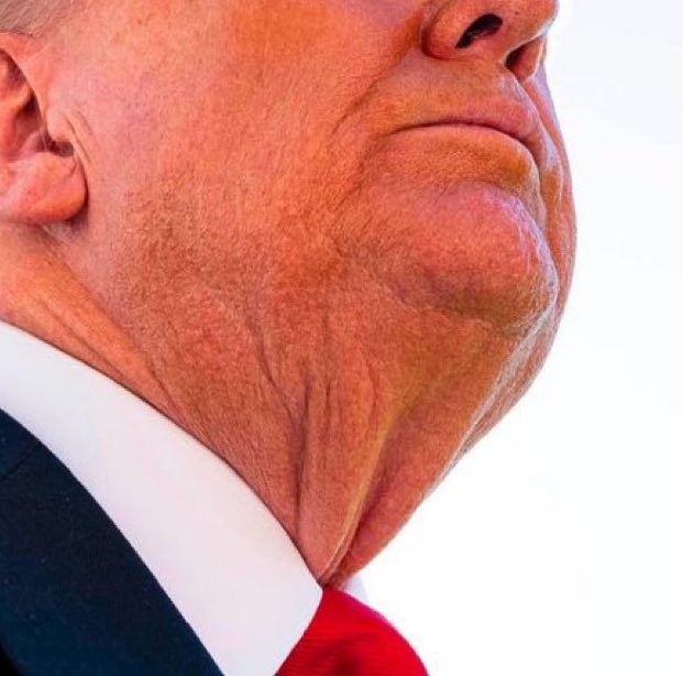 What’s wrong with Donald Trump’s neck in this Time Magazine!