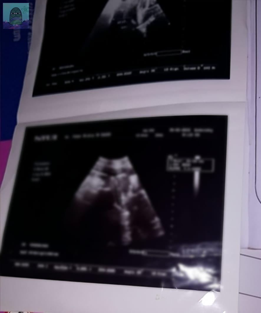 Tanyarl 💚 tweet media