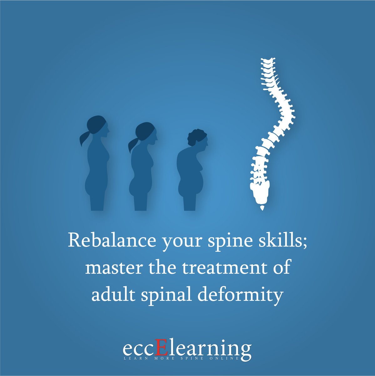 Surgeons - your blueprint for success in treating Adult Spinal Deformity is here. The course is CME-accredited and can be studied at your time and pace, from anywhere in the world. 
For treatment to triumph👉learn more: eccelearning.com/lp/adult-defor…