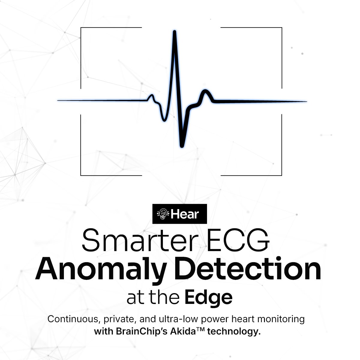 BrainChip_inc's tweet image. 🤔 What if your wearable could detect dangerous heart rhythms without draining battery or sending data to the cloud? Akida makes it possible. Real-time ECG monitoring at the edge. 💓⚡

bit.ly/AnomalyDetecti…

#BrainChip #EdgeAI #Akida