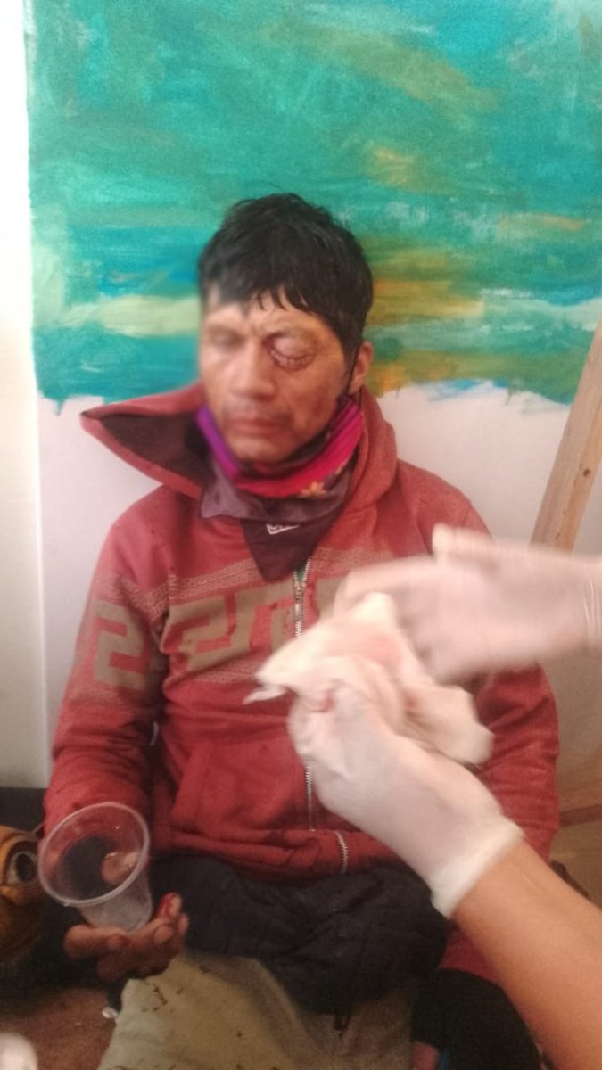 #ATENCIÓN 
#CONVOY DE LA MUERTE ☠️

Militares están ingresando a hospitales y centros de salud de Otavalo para llevarse a las personas heridas, según denuncian habitantes del cantón y la organización de derechos humanos <a href="/inredh1/">INREDH</a>

De acuerdo con estas denuncias, se habría ordenado