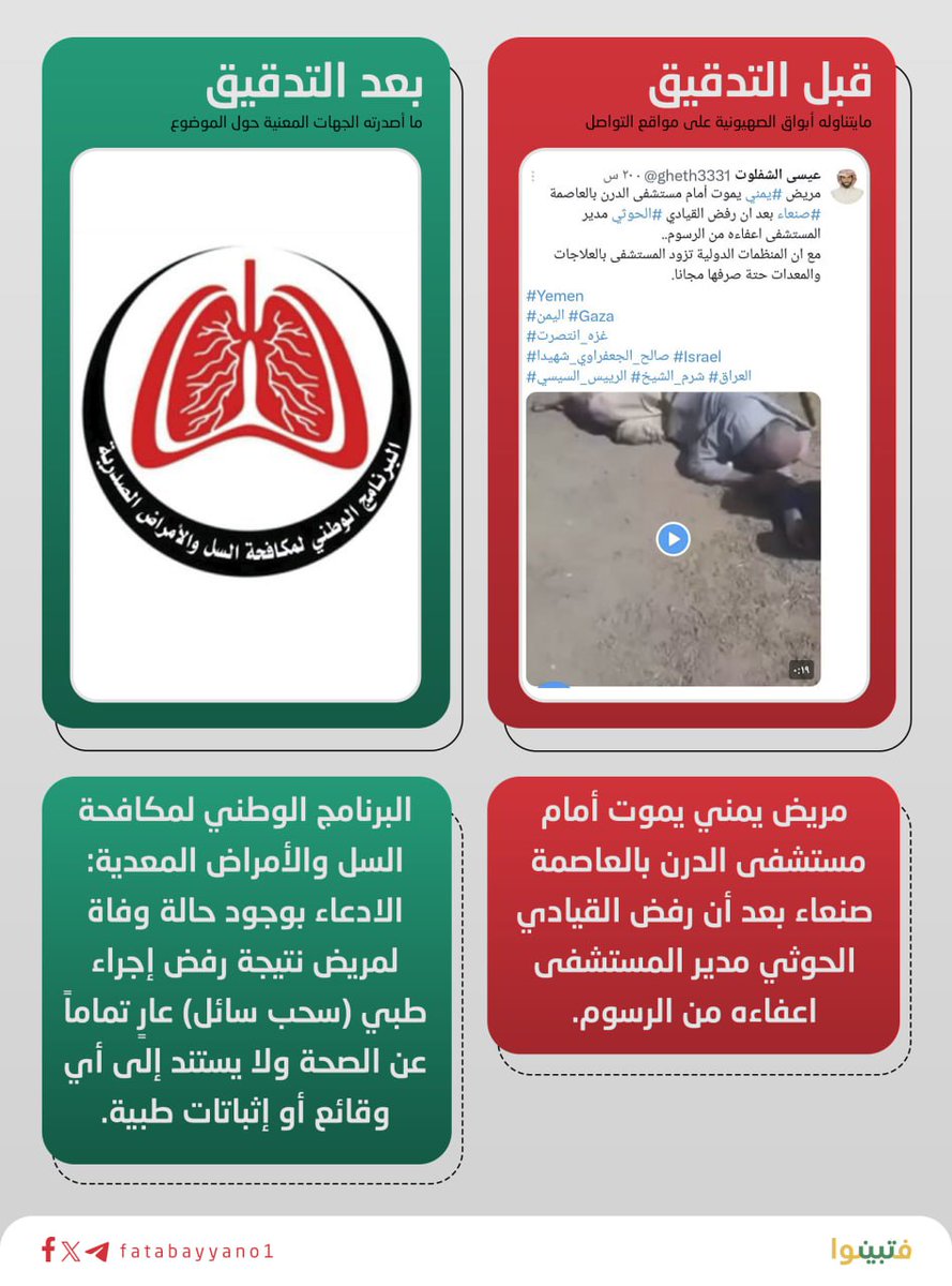 البرنامج الوطني لمكافحة السل والأمراض المعدية في صنعاء ينفي المزاعم المتداولة حول وفاة مريض أمام مستشفى الدرن بسبب رفض إعفائه من الرسوم، مؤكداً أن الادعاء لا يستند إلى أي وقائع أو إثباتات طبية. وأوضح البرنامج أنه بعد مراجعة السجلات لم تُسجَّل أي حالة وفاة أو بلاغ مماثل داخل