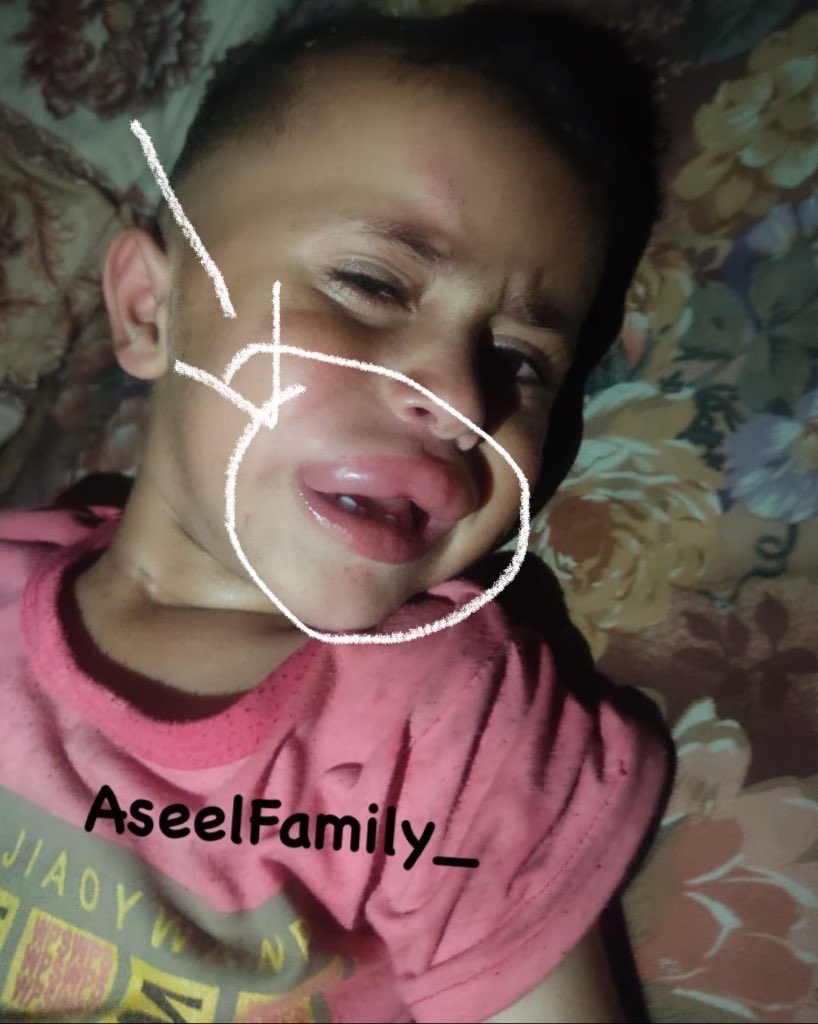My son was bitten by a Rat and is now suffering from a severe allergic reaction. He’s in critical condition and fighting for his life. Please, I beg you to pray for him and help me to save him💔💔😭

3 replies — even dots — can save my children 💔

chuffed.org/project/aseel