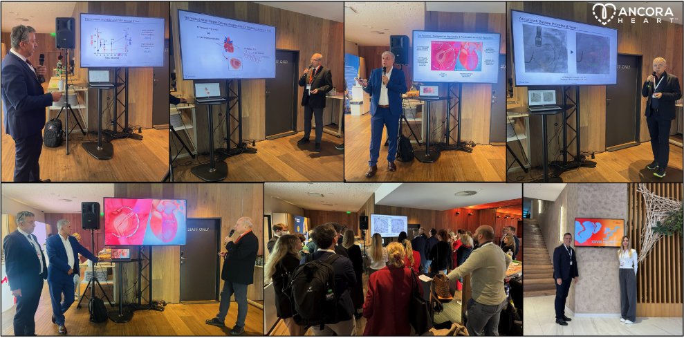 Honored to have Prof. Filip Málek, Dr. <a href="/hlinomaz/">Ota Hlinomaz</a>, Prof. Jan Krejčí &amp; Dr. Michal Rezek present the CORCINCH-HF Study and the #AccuCinch System at the Czech Heart Failure Association Conference. Our team, including Michael Zapien and Nataša Panić, attended the conference and