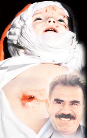 Abdullah Öcalan, Bebek katili bir piçtir!