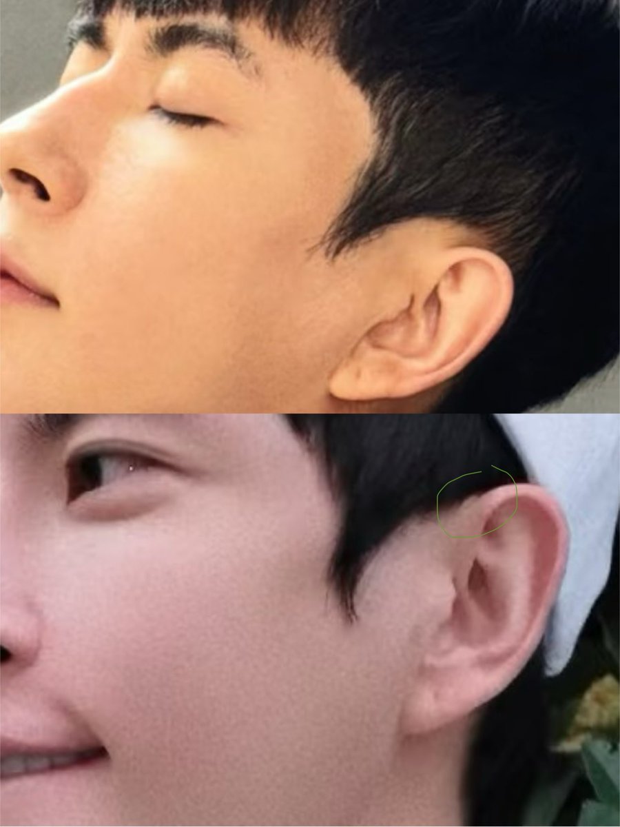 jin474128's tweet photo. 和去年的照片对比，8月份他发的笔记照片耳前的异物感好重，是贴了什么东西吗？ #于朦胧
#YuMenglong https://t.co/4SJzjaRRIn