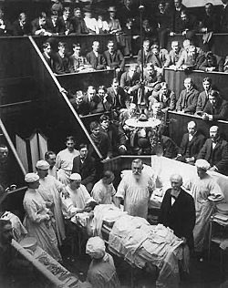 Halstedwi's tweet image. Vincenz Czerny, cirujano de Bohemia, hoy Trutnov, Rep. Checa. Entre sus múltiples aportaciones a la cirugía, extirpó un tumor de mama y al mismo tiempo colocó un lipoma gigante de la misma paciente a modo de prótesis. #cirugía #cirujanos