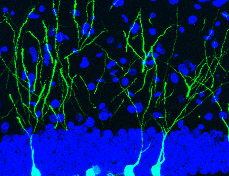 ScienceTM's tweet image. A new study implicates a deficiency of the ribosome quality control factor ASCC3 in #FragileXSyndrome and shows that using #CRISPR to activate the factor can treat cognitive and social deficits in a young mouse model. @StanfordPath scim.ag/3KRv4SF