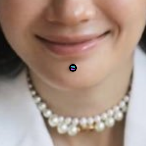 MisoB2000's tweet photo. the right mole. https://t.co/YS7OPCiZke