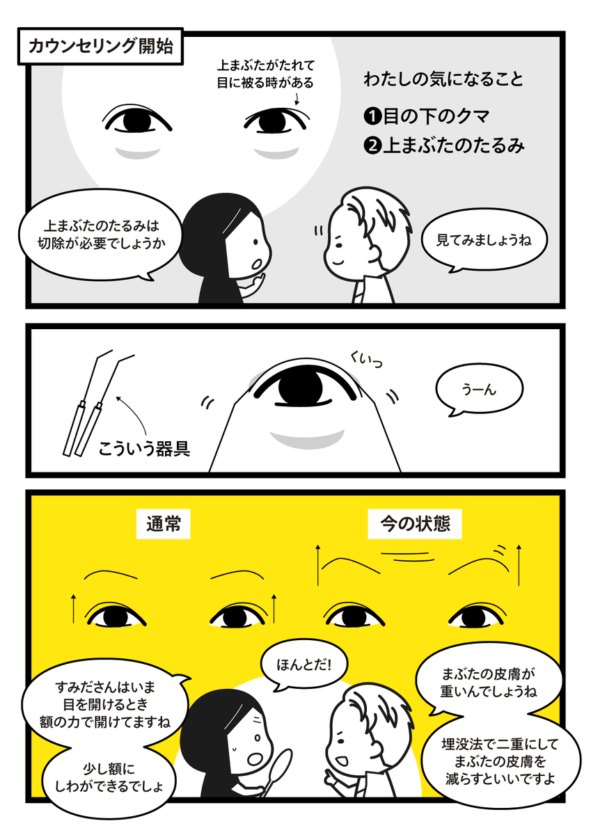 43歳でクマ改善の手術を受けた話(2/4) 