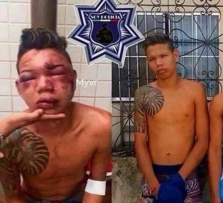 Joven tira piedra a la patrulla, la piedra golpea la llanta, rebota y le da en la cara, según el testimonio de los policías...