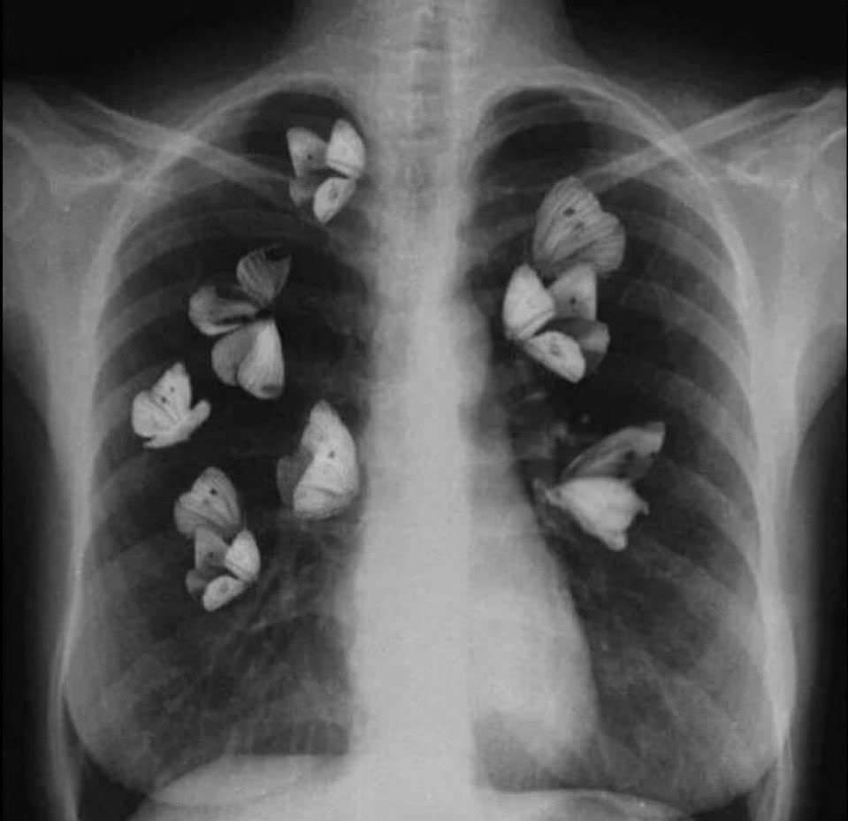 بعد ما اكلم الشخص اللي أحبببه 🤍