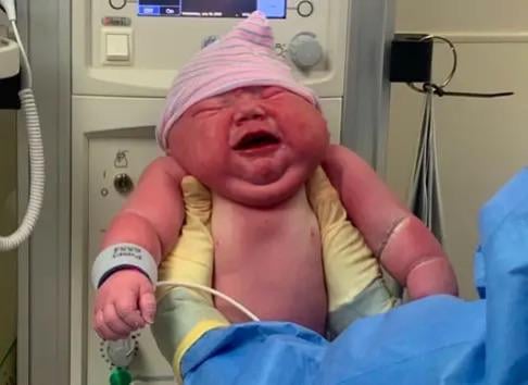 endodanli's tweet photo. Un parto que sorprendió a todo Nashville. Una madre compartió cómo su hijo llegó al mundo pesando 12.8 libras, rompiendo el récord del hospital.

Entre risas nerviosas y fotos apresuradas, el equipo midió dos veces: 5.8 kilos, confirmados. Ella dice que la sala se quedó en silencio un segundo y luego estalló en aplausos.

Lo más curioso: por más grande que parezca, ese bebé alcanza apenas el 56% del récord Guinness de 1955, cuando en Italia nació uno de 22.5 libras, 10.2 kilos. Casi nadie lo sabe.

#RécordDeNacimiento #Maternidad #SabíasQue #DrIgnacioEndo