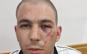AbujomaaGaza's tweet image. Dr Mohammed abu Salmiya, general Director of Al Shifa Hospital:

▪️Palestinian hostages freed from Israeli torture camps are exhausted and show clear signs of torture.
▪️Some of them had their limbs amputated.
▪️Many of them were wounded before or during their kidnapping, and…