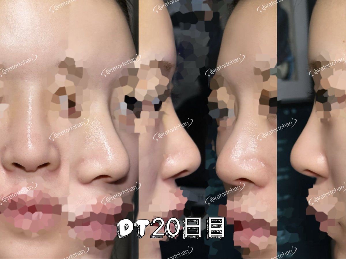retortchan's tweet photo. 《DT20》 https://t.co/sKDLmqjlWx