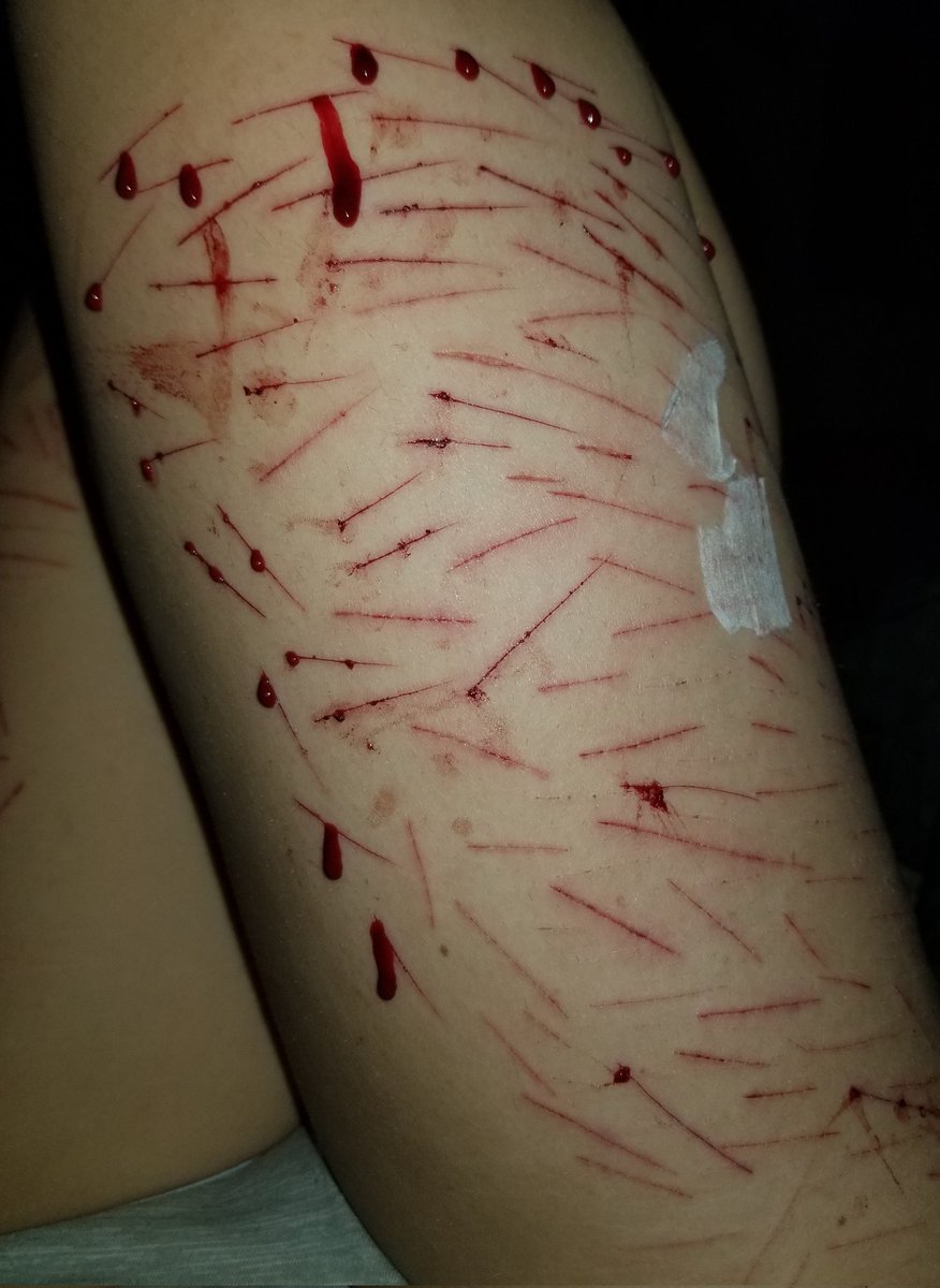 Averyyy3336's tweet photo. Tw self harm
Agh I ran out of bandages T•T
#selfharmtwt #selfharm #selfharmtw https://t.co/DxwXVG3yky