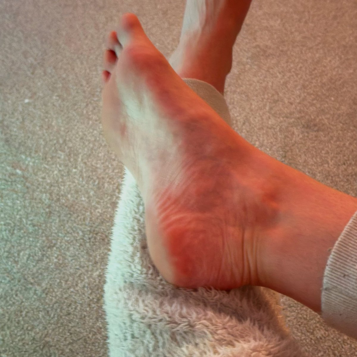 Alana Jayne Skye π (@alanajayneskye) on Twitter photo β¨ Taking it easy and giving my feet some love today. Theyβve been through a lot lately β rest, recovery, and a bit of sparkle π
π #SelfCare #RestDay #HealingVibes <a href="/iam_the_eagle/">iam_the_eagle</a> β¨ Taking it easy and giving my feet some love today. Theyβve been through a lot lately β rest, recovery, and a bit of sparkle π
π #SelfCare #RestDay #HealingVibes <a href="/iam_the_eagle/">iam_the_eagle</a>