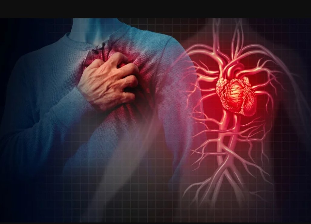 SugarDocHealth's tweet image. “𝗛𝗲 𝗷𝘂𝘀𝘁 𝘀𝗹𝘂𝗺𝗽𝗲𝗱 𝗮𝗻𝗱 𝗱𝗶𝗲𝗱.”
We hear it every now and again, but truth is, nobody just drops dead without warning.
The body always gives signs, even when we ignore them.

Most sudden collapses happen because of hidden (health) problems like high blood pressure,…