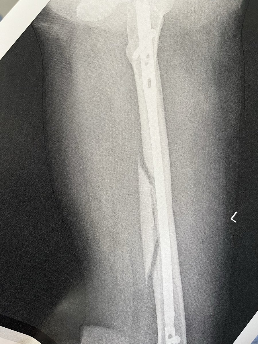 Momo (@1gJaGkPaJ9iBO8C) / Posts / X