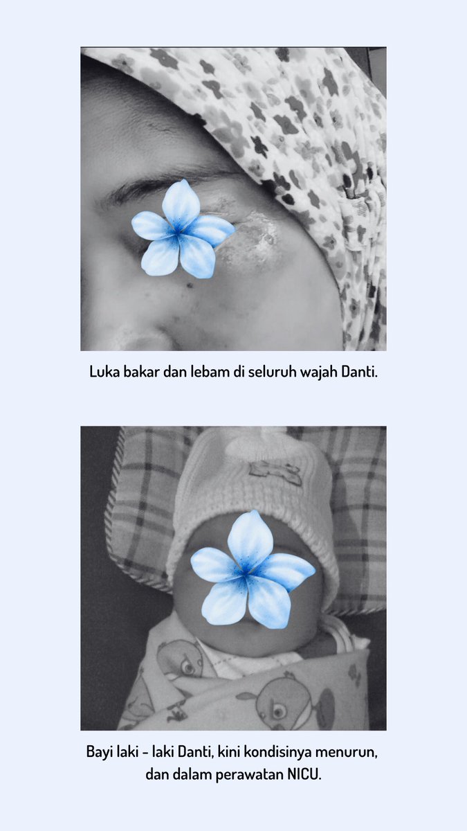 BulanRumah's tweet image. ‼️ Penggalangan Dana Darurat untuk Kasus Terbaru Rumah Bulan ‼️

Danti (22), bayinya yang baru lahir, dan anak balita perempuannya, Kanya (4), kini tengah dalam keadaan kritis. Danti dan Kanya, ditinggalkan di depan klinik bersalin oleh terduga suami siri, dan keluarganya, dalam