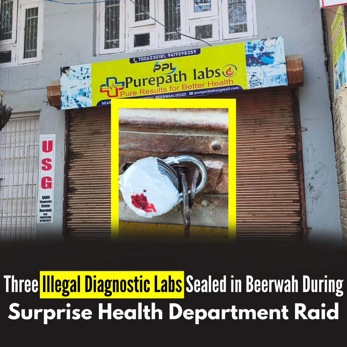 Kashmirechoes1's tweet image. Health Dept Budgam seals three unregistered diagnostic labs in Beerwah during a surprise inspection drive. Action taken to curb illegal and unsafe medical practices. ⚕️🚫
#Kashmir #Beerwah #Budgam #HealthAlert #KNT #PublicSafety