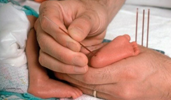 somos_pacientes's tweet photo. La Asociación @mps_lisosomales reclama incluir el síndrome de Sanfilippo en el cribado neonatal

“En estos casos es fundamental un diagnóstico precoz”, ha destacado Jordi Cruz 

https://t.co/nDxu8Z6kDc https://t.co/hCMLOIxOhX