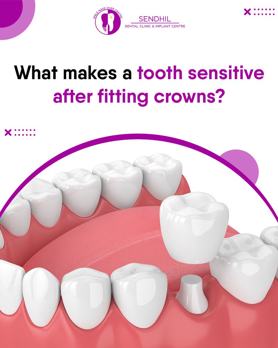 sendhil_dental's tweet image. 🦷👉 Got your new dental crown but still feeling sensitivity? 😬

Discover what’s happening beneath your crown and how to fix it before it gets worse 💙

📖 Read the full blog: sendhildental.com/what-makes-a-t…

#ToothSensitivity #DentalCrowns
