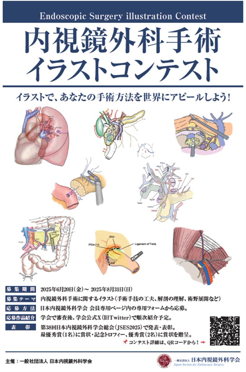 jses_eng's tweet image. 📢 Notice: Endoscopic Surgery Illustration Contest
Following the first screening, illustrations other than the top 21 entries will be posted sequentially starting from November 2025.
#JSESイラストコンテスト #JSES_illustration_contest
#JSES #EAES #SAGES #ELSA