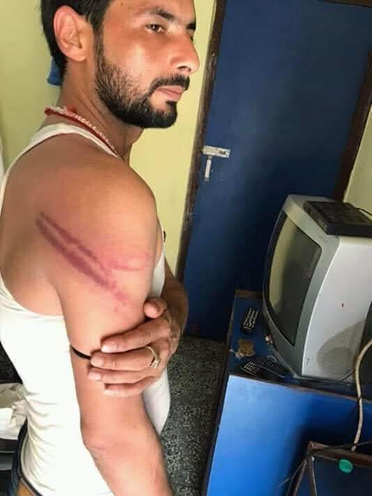 ews_army's tweet image. जिस व्यक्ति ने आपका हक और अधिकार के लाठी खाया है.
अगर उस व्यक्ति को टिकट नहीं मिलता और समझ लीजिए भाजपा आपके समाज के हीरो को इस्तेमाल कर रहा है।।
@BJP4Bihar @AshutoshBiharKa @BJP4India