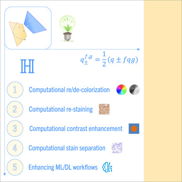 Patterns_CP's tweet image. Online Now: Computational workflows for natural and biomedical image processing based on hypercomplex algebras dlvr.it/TNhXlp #datascience
