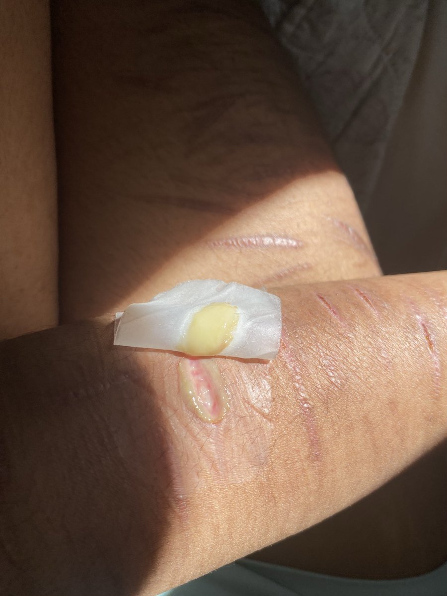 am i insane Or is this infected why is it yellow